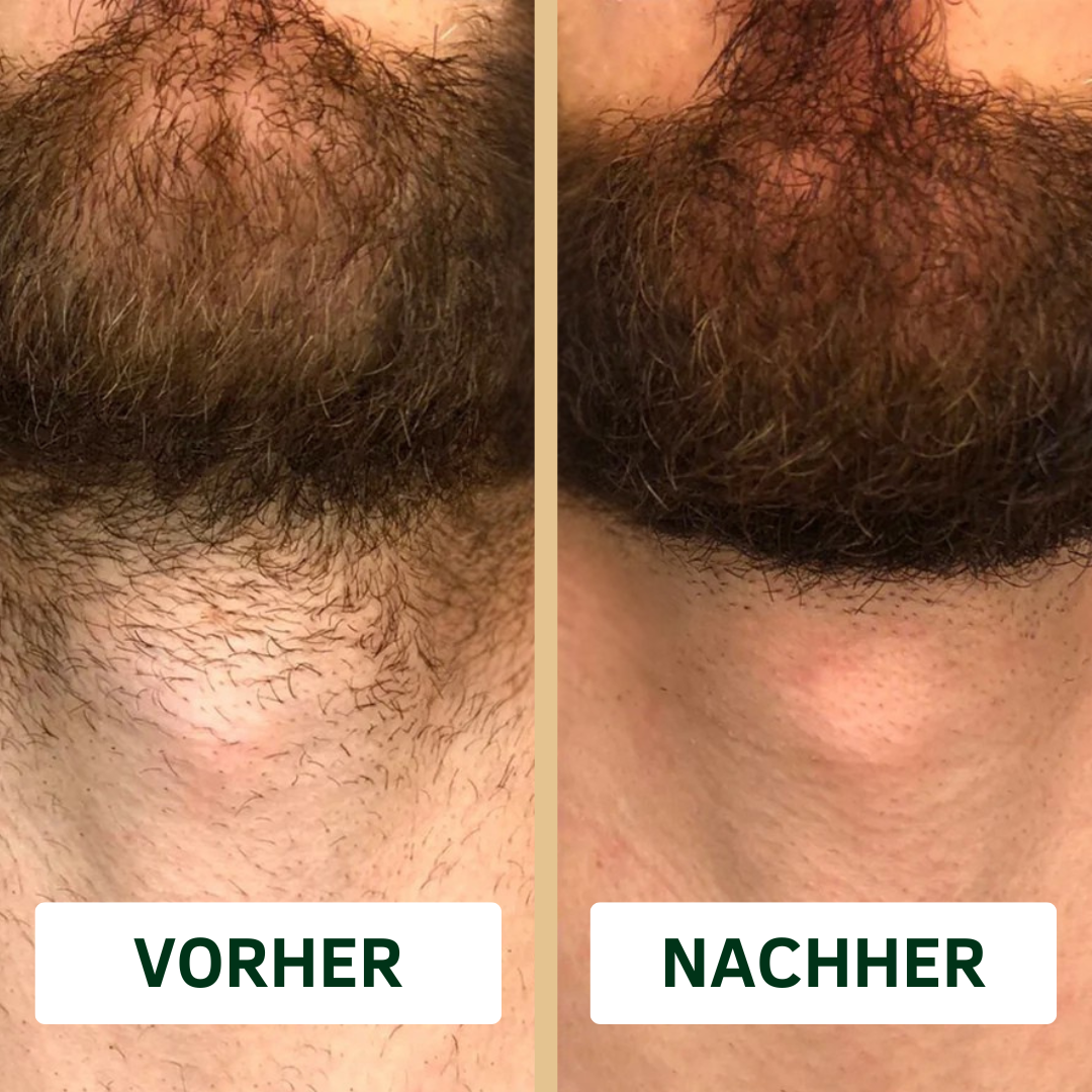 SHAVEHUB IPL PRO
