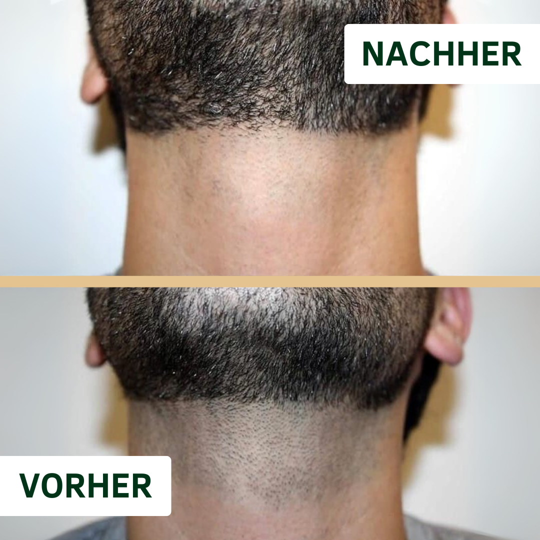 SHAVEHUB IPL PRO